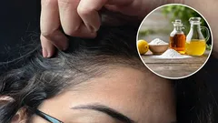 Jaké jsou výhody použití octa a jedlé sody k odstranění šedivých vlasů a jak na to správně?